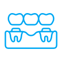 Porcelain Crowns